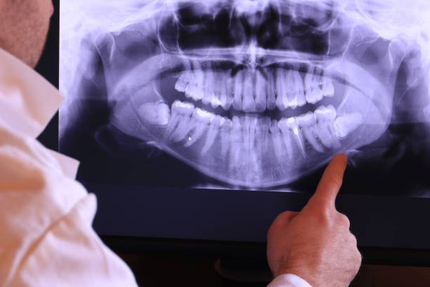 Best Emergency Dental Services for Seniors in Forestville, MD